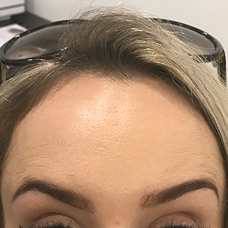 Woman's forehead