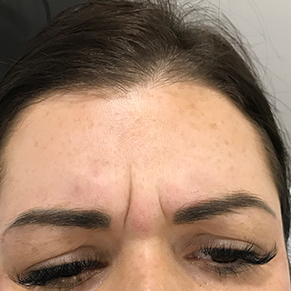 Woman's forehead whilst frowning