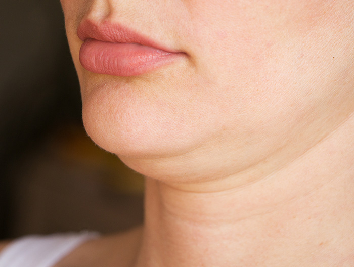 A face showing a double chin