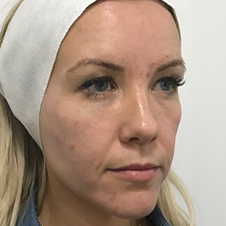 Woman's Face