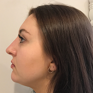 Side of Woman's Face