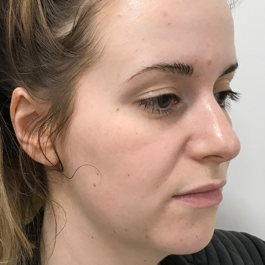 Woman's Face