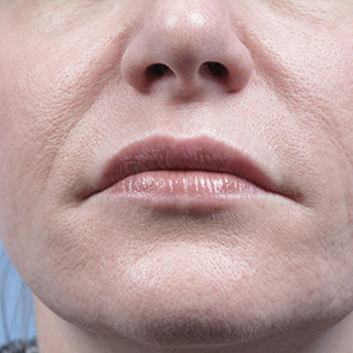 Close Up of woman's lips and chin