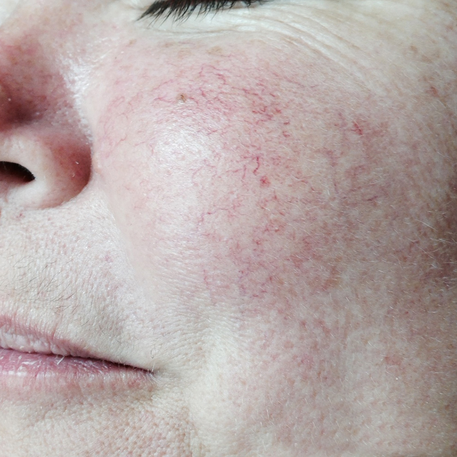 Close Up of woman's cheek