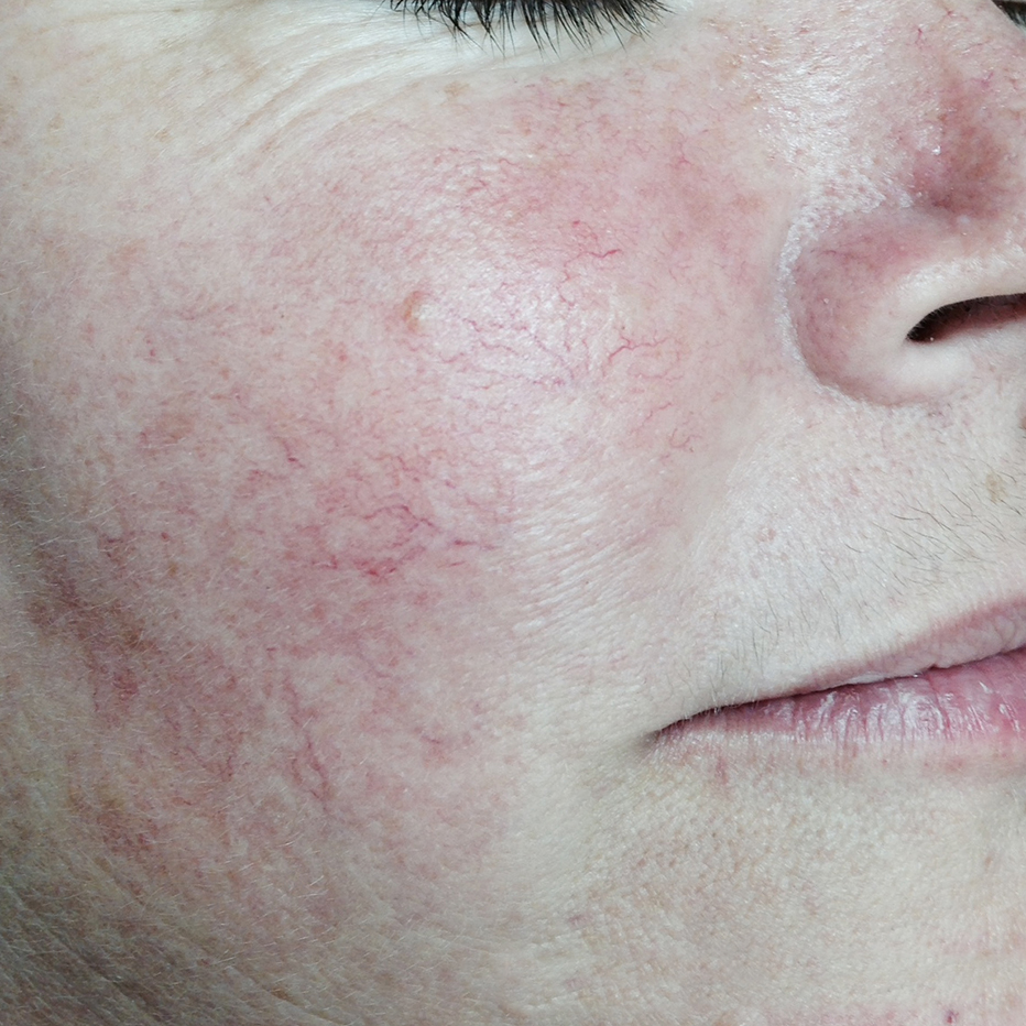 Close Up of woman's cheek