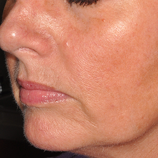 Woman's jaw, cheek and lips