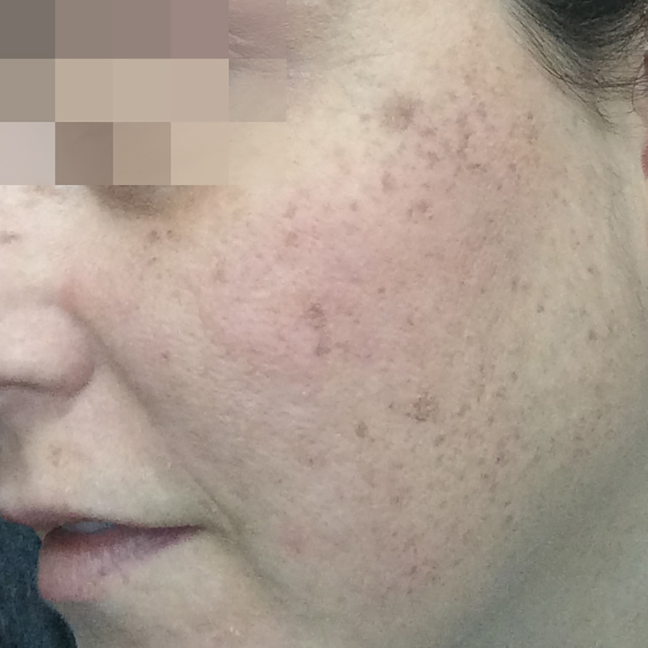 Close Up of woman's cheek