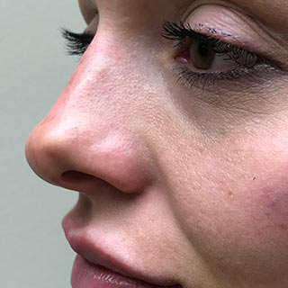 Close up of ladies nose