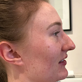 Side view of ladies face