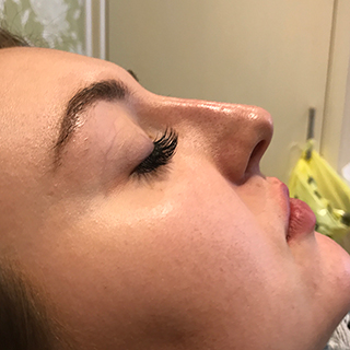 Side view of ladies face and nose