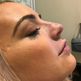 Side view of ladies face