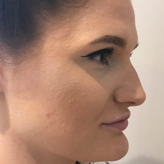 Side view of ladies nose