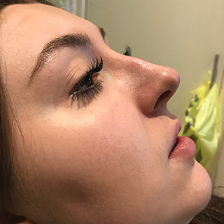 Side view of ladies face and nose