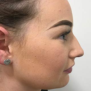 Side view of ladies face