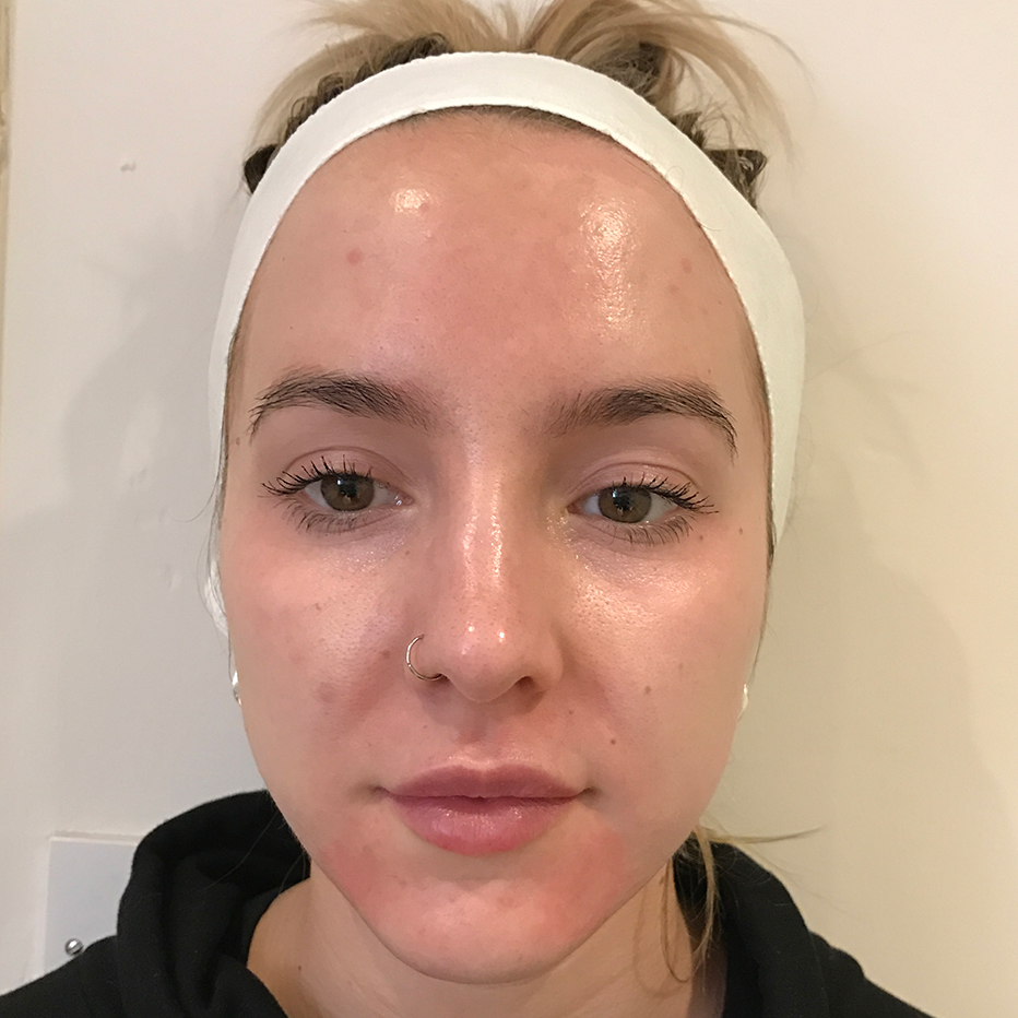 Woman's cheek with clear complextion