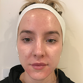 Woman's cheek with clear complextion