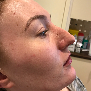 Side profile of a woman's cheek