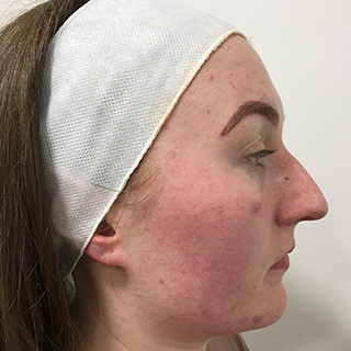 Side profile of a woman's face