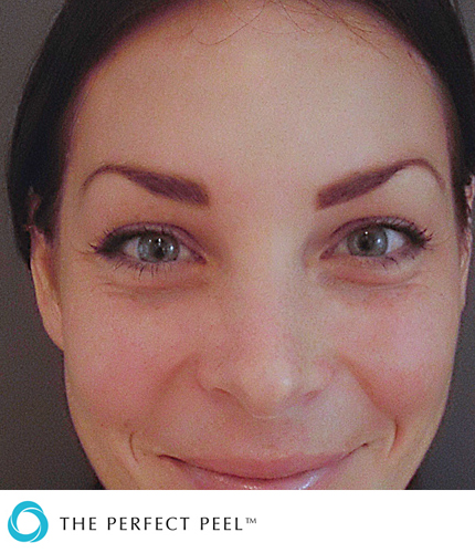 Woman looking straight forward