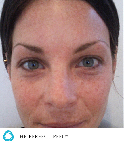 Woman looking straight forward