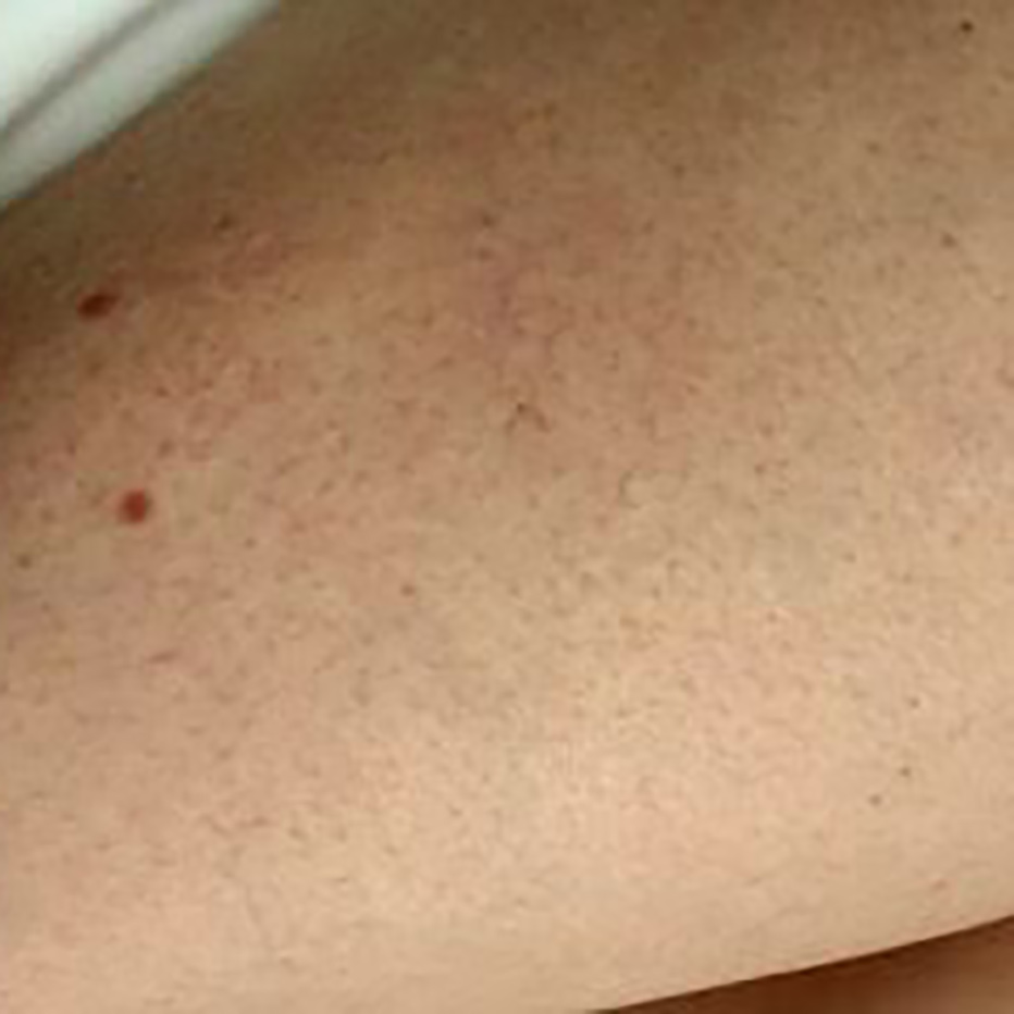 Woman's forehead